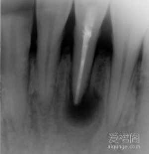 20114101143484.gif