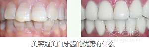 20150717094217.png