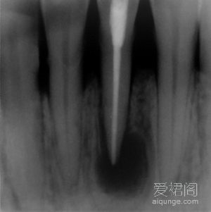 20114101143473.gif